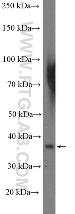 CCDC92 Antibody in Western Blot (WB)