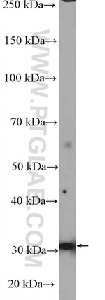 CCDC92 Antibody in Western Blot (WB)