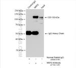 Neuropilin 2 Antibody in Immunoprecipitation (IP)