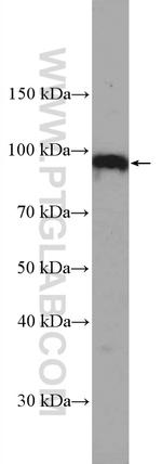 CCDC8 Antibody in Western Blot (WB)