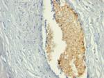 AMP Deaminase, Isoform E (AMPD3) Monoclonal Antibody (AMPD3, 901)