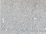 AP4S1 Antibody in Immunohistochemistry (Paraffin) (IHC (P))