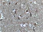 AP4S1 Antibody in Immunohistochemistry (Paraffin) (IHC (P))