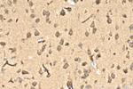 AP4S1 Antibody in Immunohistochemistry (Paraffin) (IHC (P))