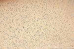 AP4S1 Antibody in Immunohistochemistry (Paraffin) (IHC (P))
