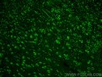 AP4S1 Antibody in Immunohistochemistry (PFA fixed) (IHC (PFA))