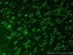 AP4S1 Antibody in Immunohistochemistry (PFA fixed) (IHC (PFA))