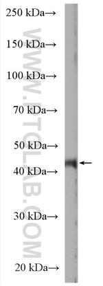 LMBRD1 Antibody in Western Blot (WB)