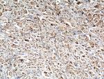 BDH2 Antibody in Immunohistochemistry (Paraffin) (IHC (P))