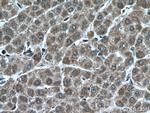 KIF13A Antibody in Immunohistochemistry (Paraffin) (IHC (P))