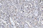 TGFBR2 Antibody in Immunohistochemistry (Paraffin) (IHC (P))