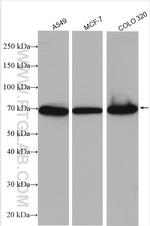 TGFBR2 Antibody in Western Blot (WB)