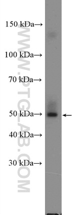 BAF53B Antibody in Western Blot (WB)