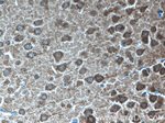 KIF2A Antibody in Immunohistochemistry (Paraffin) (IHC (P))