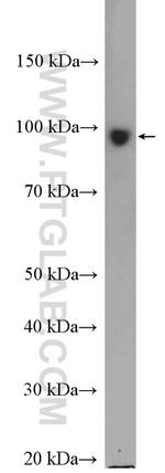 KIF2A Antibody in Western Blot (WB)