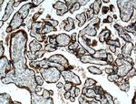 ITGA5 Antibody in Immunohistochemistry (Paraffin) (IHC (P))