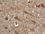 CACNA1E Antibody in Immunohistochemistry (Paraffin) (IHC (P))