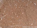 CACNA1A Antibody in Immunohistochemistry (Paraffin) (IHC (P))
