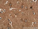 CACNA1A Antibody in Immunohistochemistry (Paraffin) (IHC (P))