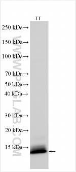 ASXL2 Antibody in Western Blot (WB)