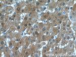 SELENBP1 Antibody in Immunohistochemistry (Paraffin) (IHC (P))