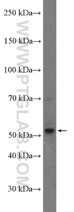SELENBP1 Antibody in Western Blot (WB)