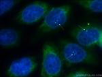 ALMS1 Antibody in Immunocytochemistry (ICC/IF)