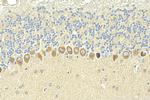 NMDAR1/GRIN1 Antibody in Immunohistochemistry (Paraffin) (IHC (P))