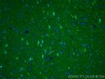 NMDAR1/GRIN1 Antibody in Immunohistochemistry (PFA fixed) (IHC (PFA))