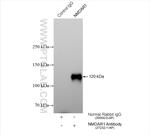 NMDAR1/GRIN1 Antibody in Immunoprecipitation (IP)