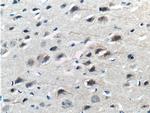 ASIC1 Antibody in Immunohistochemistry (Paraffin) (IHC (P))