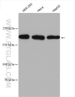 RICTOR Antibody in Western Blot (WB)