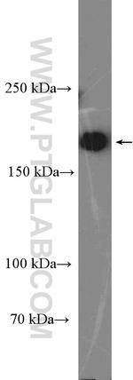 RICTOR Antibody in Western Blot (WB)