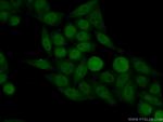 Neurofibromin Antibody in Immunocytochemistry (ICC/IF)