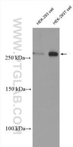 Neurofibromin Antibody in Western Blot (WB)