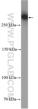 Neurofibromin Antibody in Western Blot (WB)