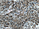 KMT2D Antibody in Immunohistochemistry (Paraffin) (IHC (P))