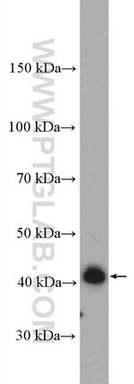 AS3MT Antibody in Western Blot (WB)