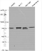 SHANK2 Antibody in Western Blot (WB)
