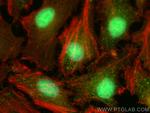 TRIM55 Antibody in Immunocytochemistry (ICC/IF)