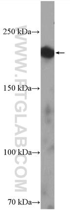 KIF21A Antibody in Western Blot (WB)