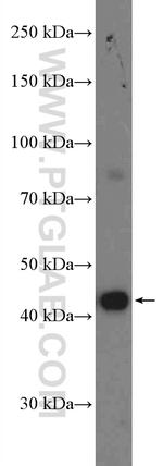 KLHDC1 Antibody in Western Blot (WB)