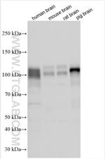 NLGN4X Antibody in Western Blot (WB)