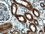 HO-1/HMOX1 Antibody in Immunohistochemistry (Paraffin) (IHC (P))