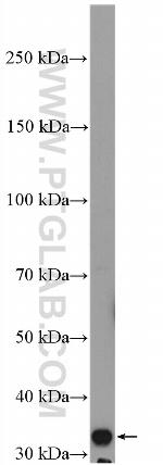 HO-1/HMOX1 Antibody in Western Blot (WB)