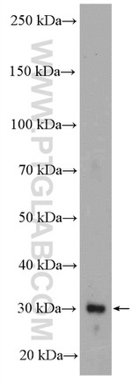 HO-1/HMOX1 Antibody in Western Blot (WB)