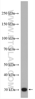 HO-1/HMOX1 Antibody in Western Blot (WB)