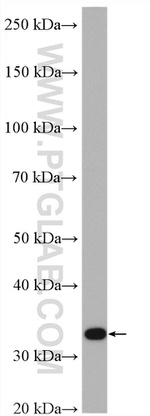 HO-1/HMOX1 Antibody in Western Blot (WB)