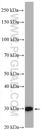 HO-1/HMOX1 Antibody in Western Blot (WB)
