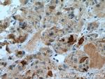 TSH beta Antibody in Immunohistochemistry (Paraffin) (IHC (P))